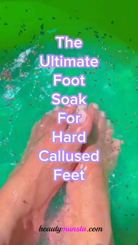 Do you have rough, hard, dry cracked feet? With this homemade foot soak you can easily loosen up that dead skin and get smooth baby soft feet! This is a foot soak for dry skin, but can also be used as a regular foot relaxer and foot detox because it contains soothing ingredients like lavender and epsom salts…. Homemade Pedicure Soak, Cracked Feet Soak, How To Get Dry Skin Off Feet, Dry Scaly Feet Remedies, How To Get Your Feet Soft, Home Pedi Foot Soaks, Dry Calloused Feet Remedy, How To Get Feet Smooth, How To Get Rid Of Rough Feet Dry Skin