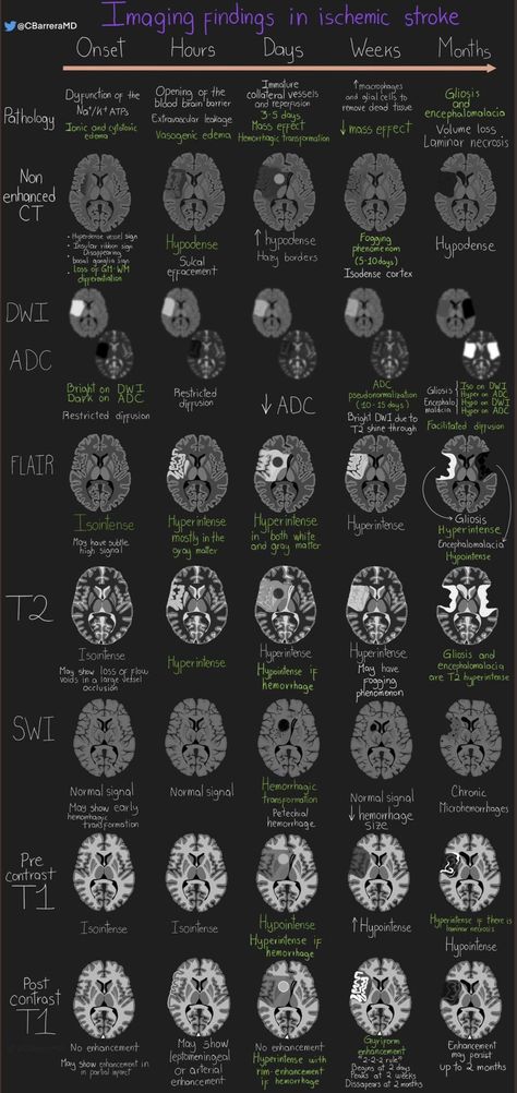 Medical Radiography, Med School Study, Radiology Student, Radiology Technician, Radiology Imaging, Studying Medicine, Medical School Life, Medicine Studies, Basic Anatomy And Physiology