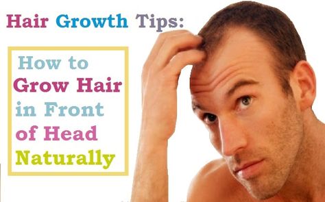 Hair loss can be really distressing, so it is natural that you want to improve your hair if it’s not to your satisfaction. You have several options to re-grow your hair. Try some of these natural remedies to stimulate hair growth. It is recommended to consult your doctor before taking supplements.Hair growth tips: How to grow hair in front of the head naturallyHow to Make Your Hair Grow Faster:  Natural Remedies and Medical ProceduresHair LossHair consists of the keratin mate How To Grow Your Front Hair Faster, Grow Hair Back, Regrow Lost Hair, Ways To Grow Hair, Hair Formulas, Make Your Hair Grow Faster, How To Grow Hair, Hair Grow Faster, Natural Hair Regrowth