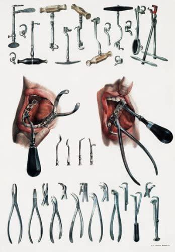 Amazon.com: ML21 Vintage 1800's Medical Dentist Tooth Extraction Dental Tools & Equipment Anatomical Anatomy Poster Re-Print - A4 (297 x 210mm) 11.7" x 8.3": Posters & Prints Tooth Extraction Healing, Dentist Tools, Teeth Whitening Homemade, Emergency Dentist, Dental Art, Tooth Extraction, Dental Crowns, Dental Teeth, Medical Dental