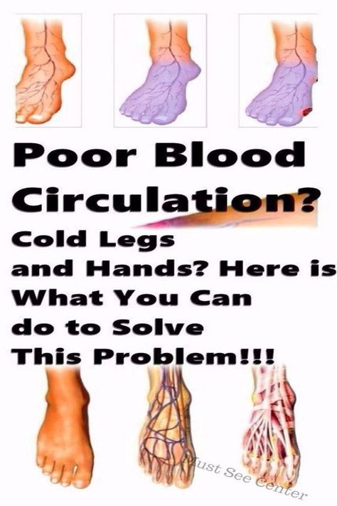 Blood Circulation Remedies, Bad Circulation, Varicose Vein Remedy, Poor Digestion, Reducing High Blood Pressure, Poor Circulation, Circulatory System, Cold Hands, Health Info