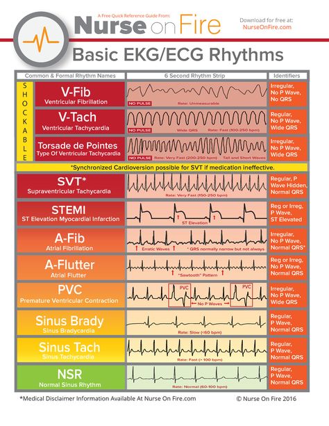 Urgent Care Nurse, Room Basic, Ed Nurse, Nursing School Essential, Emergency Room Nurse, Nurse Study Notes, Nursing Schools, Cardiac Nursing, Nursing School Survival