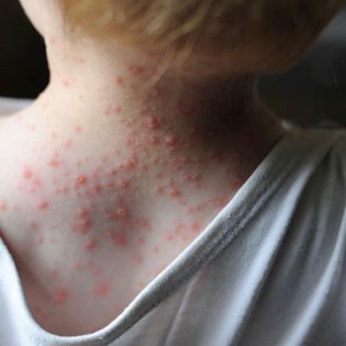 What causes skin rashes in children? Find out what's giving your baby or toddler a skin rash on WhatToExpect.com. Viral Rash, Types Of Skin Rashes, Common Skin Rashes, Toddler Rash, Types Of Rashes, Nurse Things, Home Remedies For Skin, Heat Rash, Skin Rashes