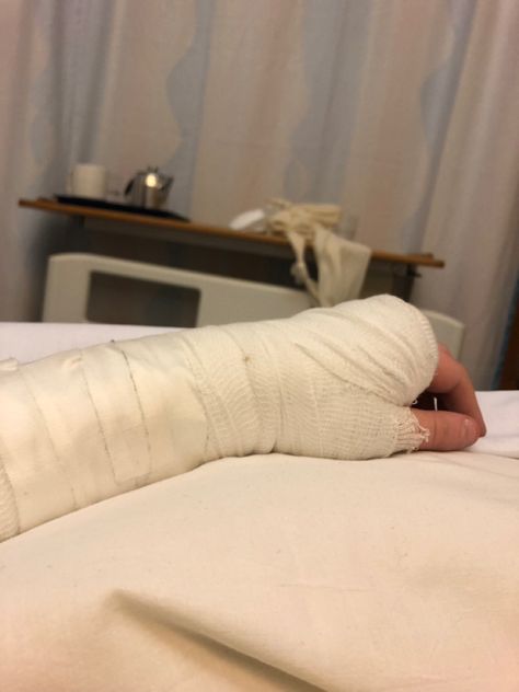 Sick Aesthetics Hospital, Arm Fracture Snapchat, Broken Arm Cast Snapchat, Broken Hands Fake Story, Arm Cast Aesthetic, Hand Fracture Pics, Broken Arm Cast, Fractured Arm, Arm Injury