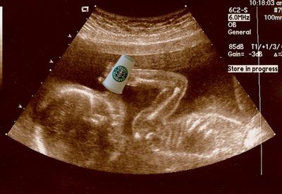 Ahahaha!!! I love it!!! Lab Humor, Girl Problems, Coffee Love, Ultrasound, Coffee Humor, Coffee Addict, My Way, I Laughed, Coffee Lover