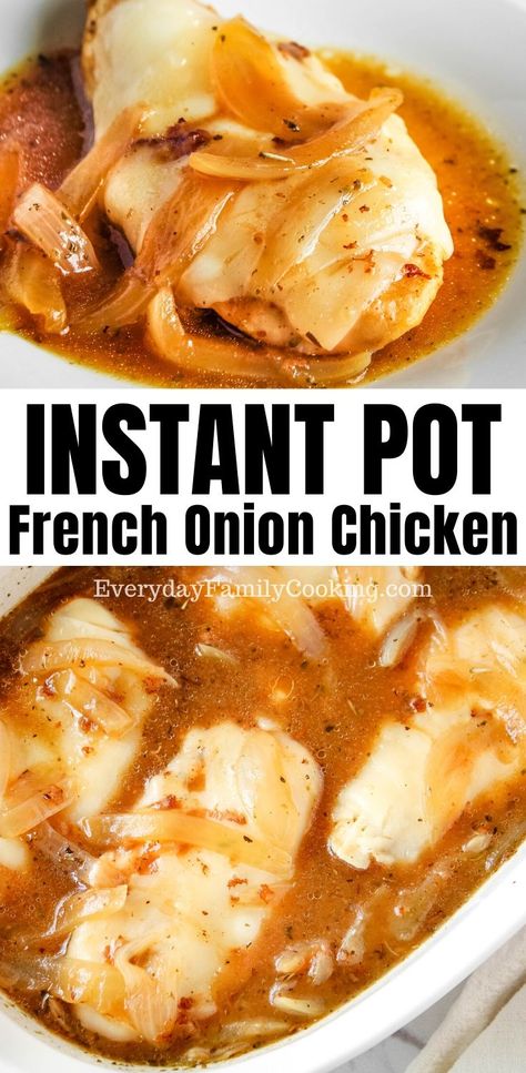 Chicken With Beef Broth Recipes, French Onion Chicken Instant Pot, Instant Pot Chicken Recipes Breast, Instant Pot Chicken Breast Recipes Easy, Chicken Breast Pressure Cooker Recipes, Chicken Breast Pressure Cooker, Instapot Chicken Breast, Chicken Breast Recipes Instant Pot, Chicken Breasts Instant Pot