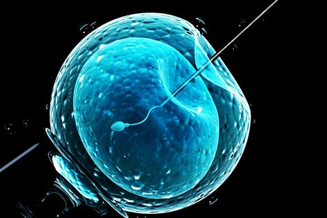 In Vitro Fertilization Process, Fertilization Process, Ivf Procedure, Ivf Cost, Artificial Insemination, Assisted Reproductive Technology, Fertility Doctor, Ivf Cycle, In Vitro Fertilization