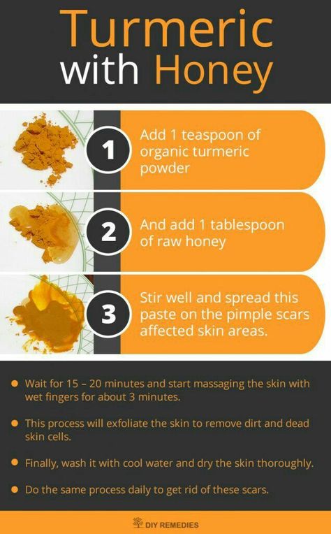 Tumeric For Acne, Acne Scar Remedies, Acne Scar Mask, Turmeric And Honey, Turmeric Face Mask, Tumeric Face Mask, Skin Care Routine For 20s, Natural Acne, Acne Scar Removal