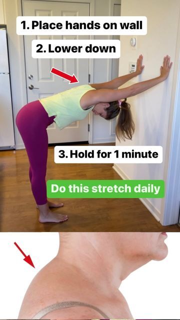 Body Stretches Flexibility, Dowager's Hump, Better Posture Exercises, Forward Head Posture Exercises, Posture Correction Exercises, Neck And Shoulder Exercises, 2 Couples, Neck Hump, Forward Head Posture