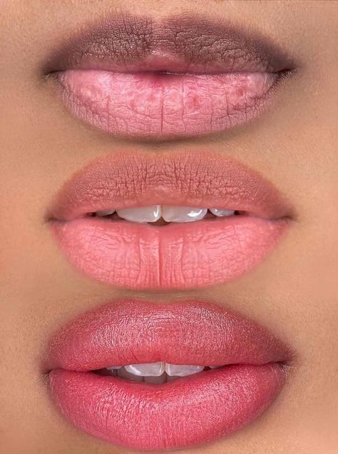 How To Lighten Dark Lips Permanently, Lip Blush On Dark Lips, What Is Lip Blushing, Natural Lip Blushing, Lip Hyperpigmentation, Lip Shading, Permanent Makeup Lips, Lip Color Tattoo, Skin Types Chart