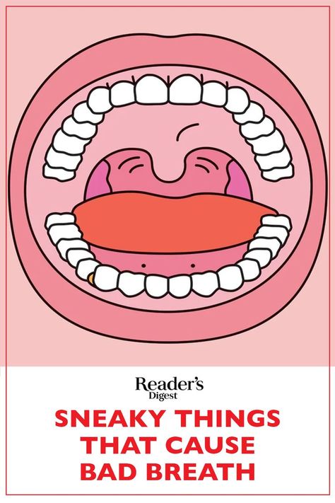 The best way to beat bad breath is to stamp it out at its source. Here's how. Remedies For Bad Breath, Causes Of Bad Breath, Mouth Care, Prevent Bad Breath, Bad Breath Remedy, Healthy Book, Common Factors, Dry Mouth, Natural Antibiotics