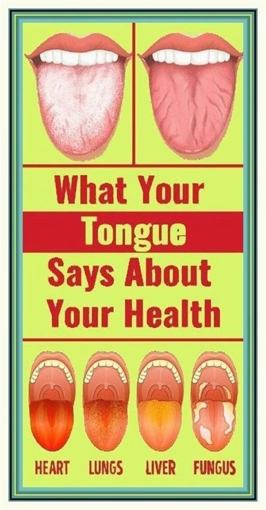 Sterling knowledge Healthy Kidneys, Tongue Health, Heart And Lungs, Family Doctors, Medical Problems, Natural Treatments, Health Awareness, Health Healthy, Herbal Medicine