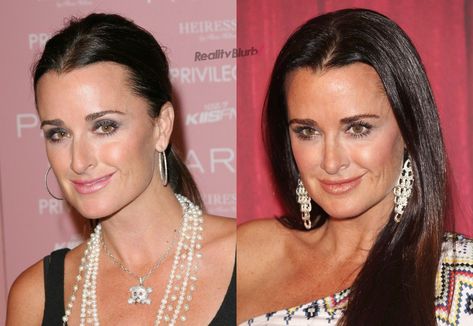 See Real Housewives of Beverly Hills' cast member Kyle Richards' before and after plastic surgery photos as she reveals which plastic surgery procedures she's had done. Kyle Richards Plastic Surgery, Kyle Richards Hair, Kyle Richards Style, Plastic Surgery Pictures, Scheana Marie, Bad Celebrity Plastic Surgery, Face Plastic Surgery, Celebrity Surgery, Plastic Surgery Photos