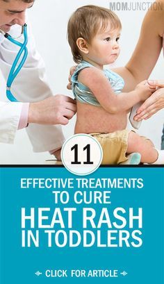 If your toddler has developed heat rash, the most important thing to ensure is that your toddler’s skin and body remain cool. Here are a few things you can do to help treat it at the earliest. Skin Rash Remedies, Heat Rash Remedy, Baby Heat Rash, Baby Rashes, Body Rash, Rashes Remedies, Heat Rash, Baby Feeding Schedule, Kids Healthy