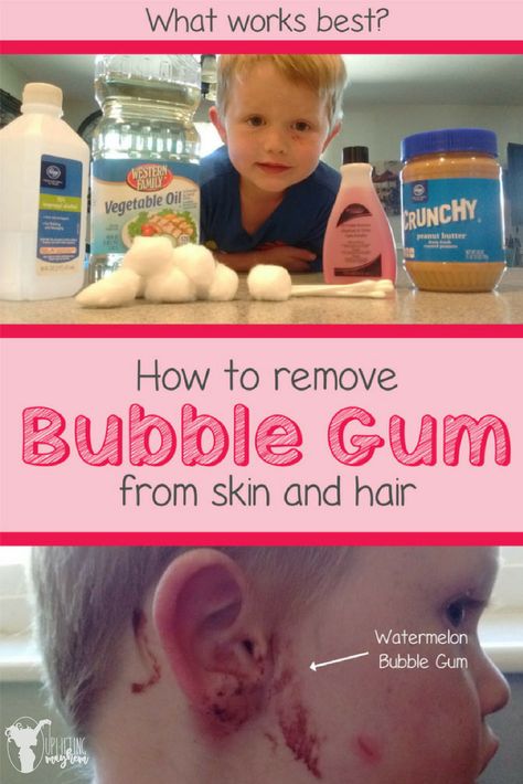 Gum stuck in hair or on skin? Here is the most painless way to remove it! How To Get Gum Out Of Hair, Gum Removal, Confidence Kids, Parenting Inspiration, Conscious Parenting, Better Parent, Gentle Parenting, Kids Parenting, Raising Kids