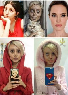 Angelina Jolie Look Alike, Angelina Jolie Plastic Surgery, Plastic Surgery Fails, Bad Plastic Surgeries, Plastic Surgery Fail, Plastic Surgery Gone Wrong, Good Soccer Players, Celebrity Plastic Surgery, Under The Knife