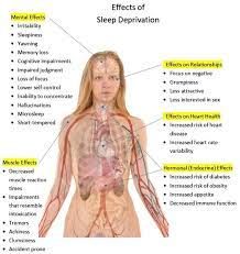 Sleep Deprivation All You Need to Know: Definition, Causes, Effects, And More! | Sleep Health Organ Trafficking, Sleep Deprivation Effects, Sinus Allergies, Human Body Organs, Muscle Twitching, Human Pictures, Human Body Parts, Increase Heart Rate, Sweat Gland