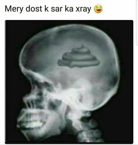 Xray Humor, Homo Erectus, Meme Show, Famous Quotes About Life, Twitter Funny, Having No Friends, Quotes About Life, Inspirational Images, Funny Pins