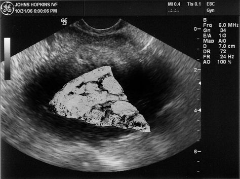 “Congratulations, it's a pizza! 💓🍕💓 #foodbaby #pizza #ultrasound #spacetrash” Pizza Quotes, Pizza Life, Pizza Photo, Pizza Branding, Pizza Art, Pizza Planet, I Love Pizza, Italian Pizza, Love Pizza