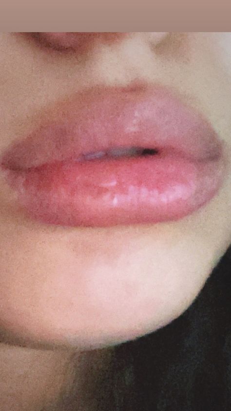 Lips, big lips, pink lips, natural lips #pinklips #lips #naturallips #tumblrlips#lipstick Big Natural Lips, Naturally Big Lips, Heavy Bottom Lip, Big Lips Girl, Flushed Lips, Big Lips Aesthetic, Naturally Bigger Lips, Round Lips, Wide Lips