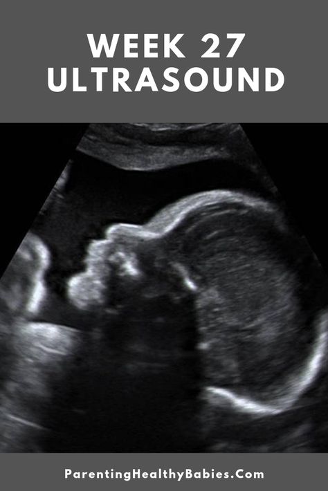 27 Week Pregnancy, Boy Ultrasound Pictures, Boy Ultrasound, Baby Ultrasound Pictures, 27 Weeks Pregnant, Pregnancy Ultrasound, 20 Weeks Pregnant, Pregnancy Week, Baby Ultrasound