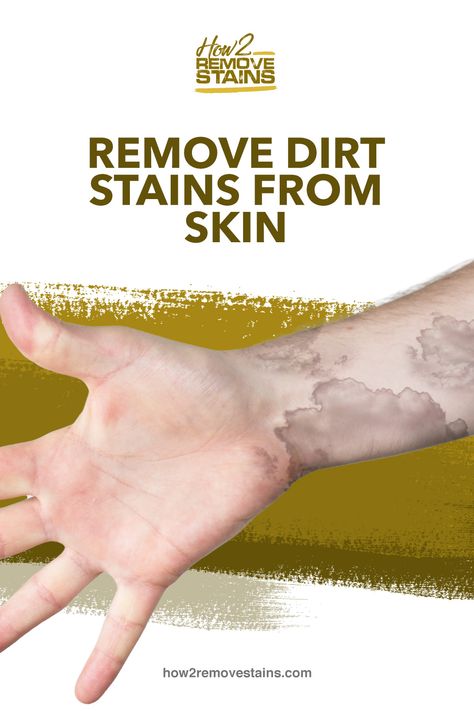 How to remove dirt stains from skin   [ Detailed Answer ]    Visit How2RemoveStains.com Dirt Removal From Skin, How To Remove Dirt From Skin, Remove Dirt From Skin, How To Remove Grass, Dry Cracked Hands, Glam Wedding Makeup, Cracked Hands, Tan Removal, Grass Stains