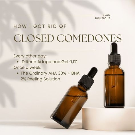 In order to treat closed comedones(also known as white heads), I was prescribed Differin by my dermatoligst. In addition to that, I apply The Ordinary AHA + BHA Peeling solution for about 10 minutes. Ordinary Aha Bha, Aha Bha Peeling Solution, Bha Peeling Solution, Closed Comedones, Peeling Solution, Skincare Essentials, Aha Bha, Skin Care Essentials, Hot Sauce Bottles