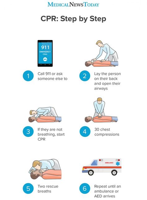 How to perform CPR: Guidelines, procedure, and ratio How To Cpr, Cpr Steps, Emergency Procedures, Infant Cpr Printable, Basic Life Support Training, Cpr Poster, Cpr Instructions, First Aid Steps, How To Do Cpr