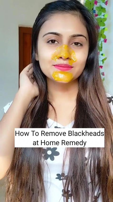 Destroy Your Moles, Warts, Blackheads, Skin tags and Age Spots Completely NaturallyFor Detail Watch Complete Video. Stay healthy and active! Share and make y... Skin Moles, Face Skin Care Routine, Natural Skin Care Remedies, Diy Skin Care Routine, Natural Face Skin Care, Skin Tags, Good Skin Tips, Remove Blackheads, Beauty Tips For Glowing Skin