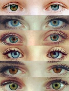 Heterochromia Iridum on Pinterest | Hitman Reborn, Pandora Hearts ... Complete Heterochromia, Sectoral Heterochromia, Heterochromia Iridum, Central Heterochromia, Mata Manga, Heterochromia Eyes, Eyeshadow Eyebrows, Beautiful Eyes Color, Different Colored Eyes