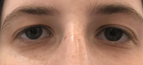 (1) Asian Hooded Eyes and Eyelash Extensions Asian Downturned Eyes, Hooded Eye Reference, Downturned Asian Eyes, How To Draw Downturned Eyes, How To Draw Hooded Eyes, Hooded Eyes Reference, Droopy Eyes Reference, Droopy Downturned Eyes Aesthetic, Two Eyes Reference