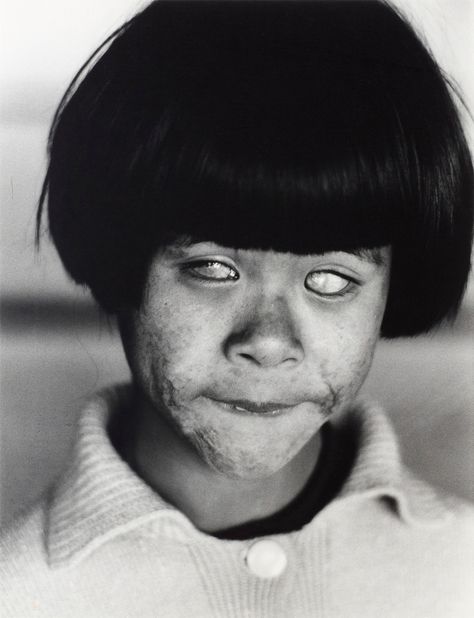 On July 26, 1945, the Allies delivered the Potsdam Declaration to the leaders of Japan, which they rejected. Six days after the bombing of Nagasaki, they accepted the exact same terms. I wish they hadn't waited ... James Nachtwey, Hiroshima Nagasaki, Nuclear Blast, Blind Girl, Hiroshima Japan, Creepy Photos, Steve Mccurry, Robert Doisneau, Fukushima