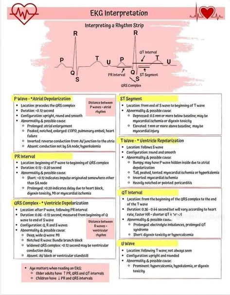 Cardiac Monitor Tech, 12 Lead Ekg Placement Cheat Sheets, Stemi Vs Nstemi Nursing, Heart Anatomy Notes, Ekg Interpretation Made Easy, Cardiac Nursing Cheat Sheets, Ekg Nursing, Charting For Nurses, Nursing School Studying Cheat Sheets