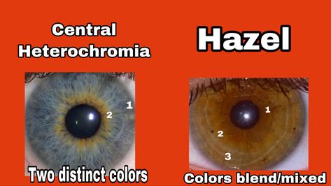 Central heterochromia vs hazel eyes differences. (I do not own the pictures used here. Used for educational purposes). found in google: credits to original owners #hazel #hazeleyes #heterochromia #heterochromiaeyes #eyes #eyecolor #centralheterochromia Hazel Vs Brown Eyes, Central Heterochromia, Pretty Eyes Color, Heterochromia Eyes, Different Types Of Eyes, Rare Eye Colors, Hazel Green Eyes, Rare Eyes, Eye Facts