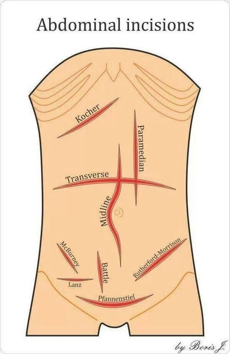 Surgical Incisions, Surgical Technologist Student, Studera Motivation, Nursing School Essential, Nursing School Motivation, Medical School Life, Nurse Study Notes, Basic Anatomy And Physiology, Nursing Student Tips