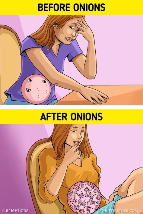 We at Bright Side gathered 5 benefits of onions you can feel if you eat them every day. Don’t miss our bonus that tells you about onions’ healing abilities. Benefits Of Onions, Onion Benefits, Healing Abilities, Hygiene Care, Health Management, Oral Health Care, Holistic Wellness, Tooth Decay, Health Advice