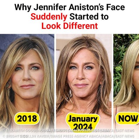 Jennifer Aniston Hair 2024, Jennifer Aniston Home, Jennifer Aniston Hair Styles, Jennifer Aniston Nose Job, Jennifer Aniston Nose, Jennifer Aniston Without Makeup, Jennifer Aniston Makeup, Jennifer Aniston Haircut, Jennifer Aniston Hair Color