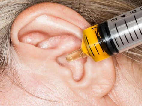 Ear Remedies Clogged, Ear Irrigation Diy, Essential Oil For Clogged Ear, Home Remedy For Ear Wax Build Up, Clogged Ears From Allergies, Dry Ears Remedy, Clogged Ear Remedy How To Get Rid, Clogged Ears Remedy, Ear Cleaner For People