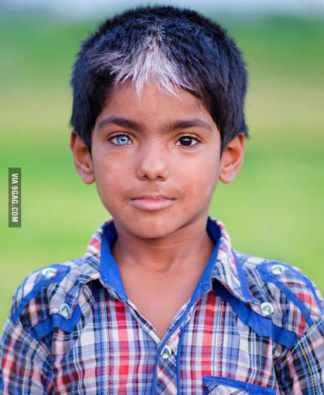 One In a Million! Unique and beautiful in his own way! (Captured by : Shahidul Islam Sahel) Rare Eyes, Different Colored Eyes, Photographie Portrait Inspiration, Unique Faces, Shooting Photo, People Of The World, Interesting Faces, Pretty Eyes, People Around The World