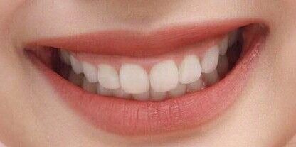 V34 Colour Corrector, Teeth Aesthetic, Pretty Teeth, Colour Corrector, Beautiful Teeth, Whitening Teeth, Gummy Smile, Perfect Teeth, Lashes Mascara