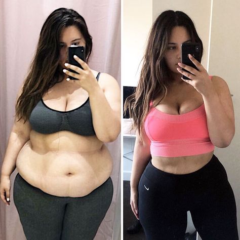 Woman Reveals Before-And-After Pictures Of Her 141-Pound Weight Loss, And She’s Completely Transparent About It | Bored Panda 230 Lbs Women, 250 To 150 Lbs Before And After, 190 Pound Woman, 150 Pound Woman 5'6, 180 Pound Woman, 200lbs To 150lbs Pictures, 200 Pound Woman, Ariana Omipi, Wegovy Before And After