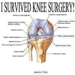 Funny Quotes About Knee Surgery by @quotesgram Knee Surgery Humor, Injury Quotes, Surgery Prayer, Surgery Quotes, Surgery Humor, Knee Operation, Recovery Humor, Funny Poems, Hip Surgery