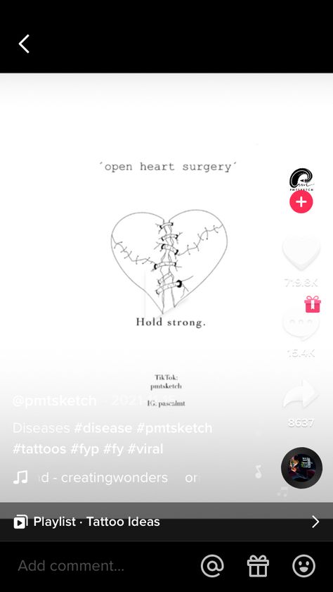 Open Heart Surgery Tattoo, Heart Surgery Tattoo, Surgery Tattoo, Open Heart Surgery, About Heart, Heart Surgery, Open Heart, Tattoos For Guys, Surgery