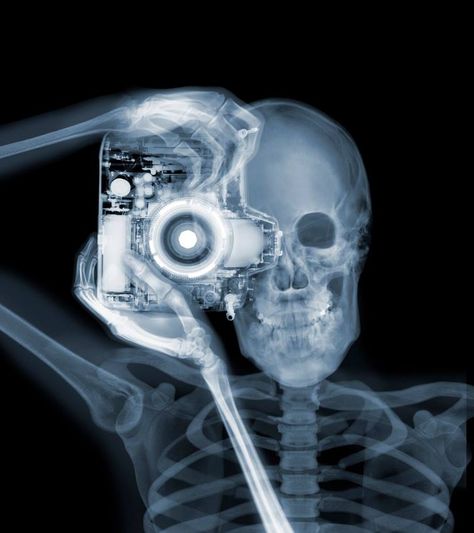 Photographer Nick Veasey has made a name for himself by photographing large objects using X-Rays instead of visible light. The 6-minute video above is a lo Daniel Richter, Xray Art, Charley Harper, Visible Light, Radiology, Anatomy Art, X Ray, Black Aesthetic, Wall Collage