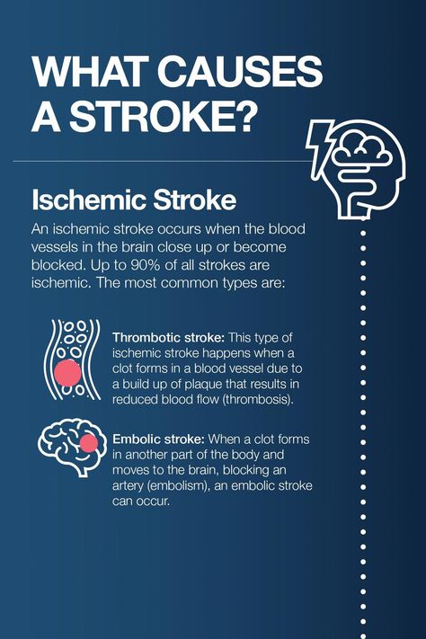 Types Of Strokes, Brain Surgeon, Amino Acid Supplements, Health And Fitness Magazine, Healthy Diet Tips, Daily Health Tips, Fitness Advice, Lower Blood Sugar, Good Health Tips