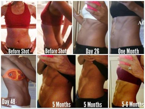 Abs transformation Abs Progress, Ab Transformation, Abs Transformation, Female Abs, Abs Women, Glow Up?, Bodybuilding