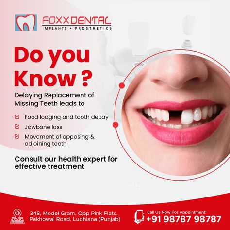 Dental Post, Dental Ads, Impacted Tooth, Preventive Dentistry, Dental Posts, Tooth Replacement, Missing Teeth, Teeth Health, How To Prevent Cavities