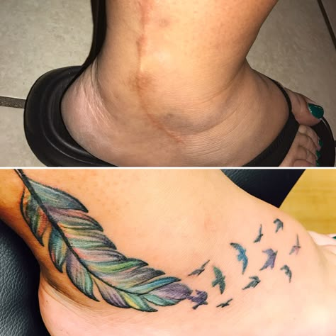 Scar cover up! Ankle Tattoo To Cover Scar, Ankle Scar Tattoo Ideas, Tattoo Ideas For Scar Cover Up, Surgical Scar Tattoo Cover Up, Ankle Scar Tattoo Cover Up, Ankle Scar Tattoo, Tattoo Ideas To Cover Scars, Tattoo Scar, Tattoo Over Scar