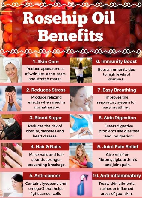 Benefits Of Rosehips, Rose Hip Oil Benefits, Rosehip Oil Benefits, 200 Questions, Rose Hip Oil, Kids Questions, Essential Oils For Pain, Essential Oils Guide, Essential Oils Herbs