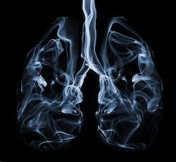 Lungs Illustration, Smokers Lungs, Lungs Art, Human Lungs, Healthy Life Hacks, Health Podcast, Unhealthy Diet, Natural Pain Relief, Quality Pictures